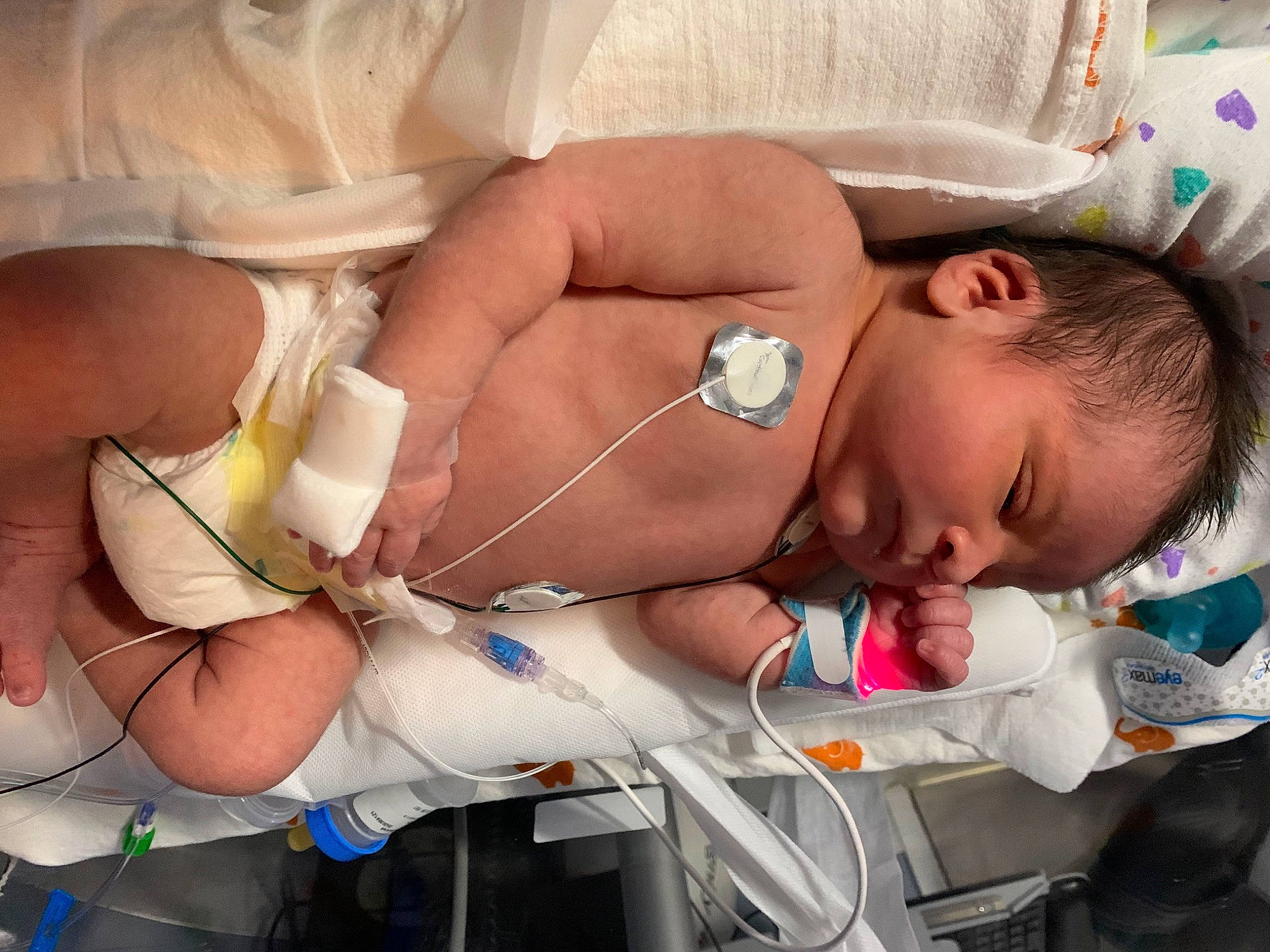 Joaquin is registered to the contest to win money with this photo: abdomen, baby, baby_products, chest, child, comfort, event, eyelash, finger, health_care, medical_equipment, medical_procedure, nail, pediatrics, person, product, service, skin, thumb, toddler