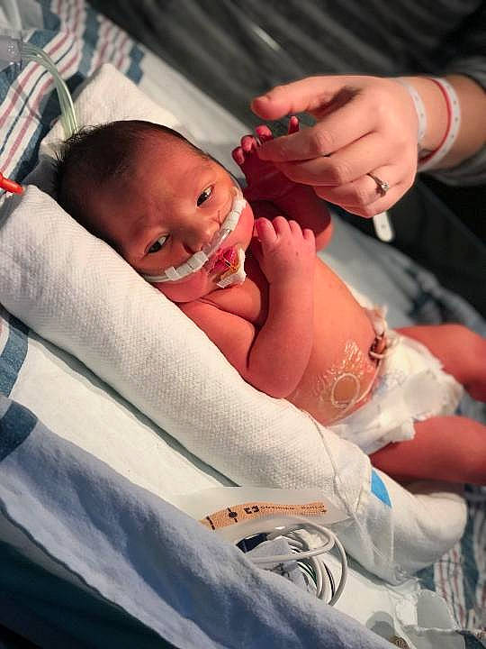 Bear is registered to the contest to win money with this photo: abdomen, arm, baby, baby_toddler_clothing, cheek, comfort, event, finger, gesture, hand, health_care, hospital, human_body, medical_equipment, mouth, patient, person, skin, stomach, thumb