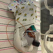 Treyvion is registered to the contest to win money with this photo: baby, bed, blanket, breathing_mask, care, cute, healthcare, hospital, incubator, infant, lying_down, medical, newborn, nursery, patient, small, striped, swaddle, tube, wrapped