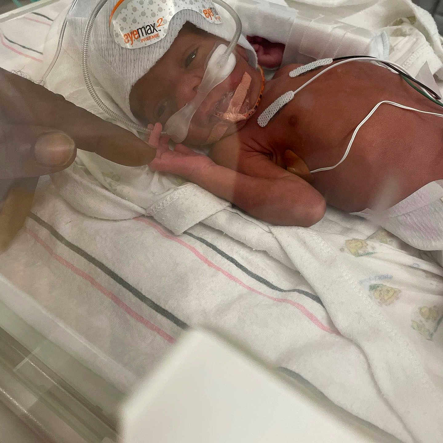 Treyvion joined the competition — help win amazing prizes! adult_finger, baby_in_bed, close_up, eye_mask, fragile, healthcare, hospital, hospital_room, incubator, infant, medical_care, medical_equipment, neonatal, newborn, patient, premature_baby, sensors, tiny_hand, tubes, white_blanket