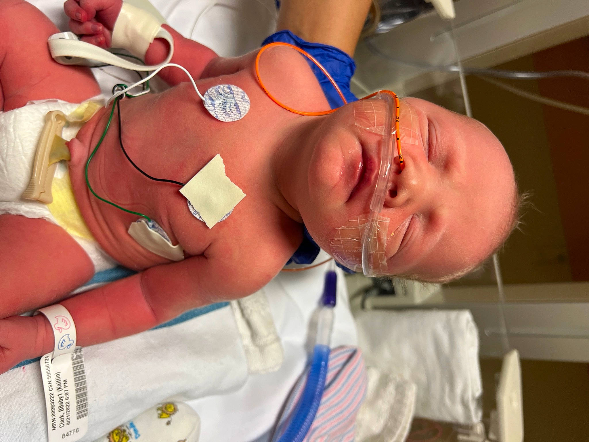 Finnley joined the competition — help win amazing prizes! abdomen, barechested, chest, clinic, comfort, elbow, event, eyewear, fun, glasses, hat, health_care, hospital, medical, medical_procedure, patient, person, service, sorrow, thigh