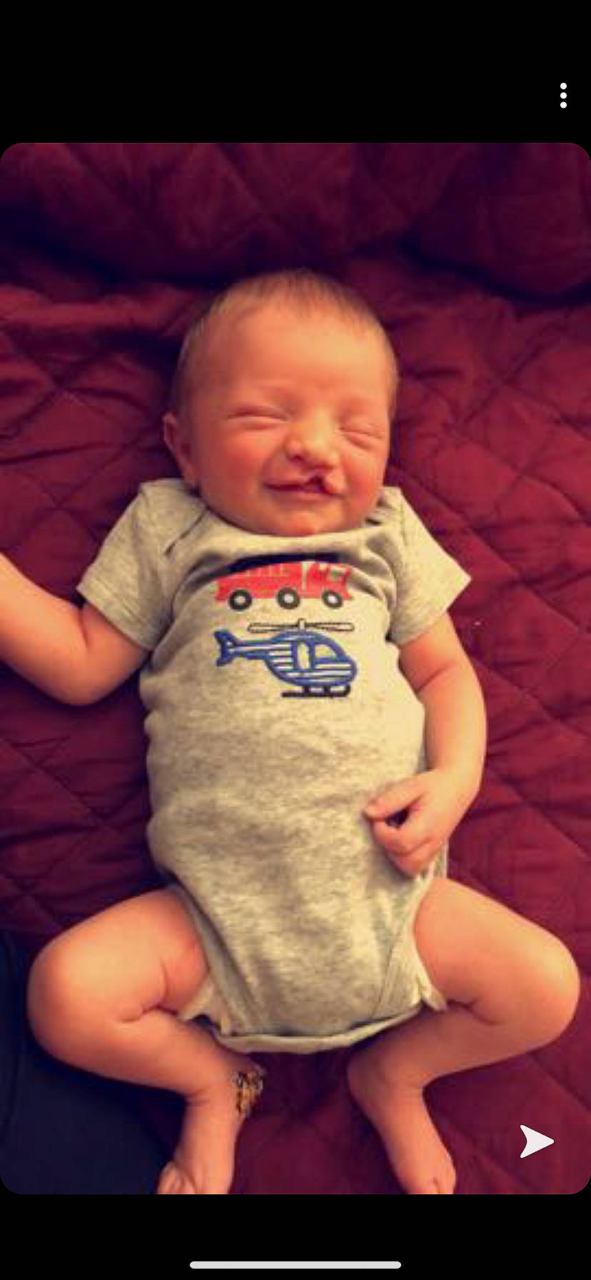 Canaan is registered to the contest to win money with this photo: baby, baby_laughing, baby_toddler_clothing, cheek, child, facial_expression, head, mouth, nose, person, skin, sleep, smile, toddler