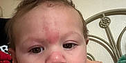 Matthias is registered to the contest to win money with this photo: baby, face, child, skin, hair, mouth, hand, arm, red_marks, bed_frame, indoor, close_up, curious, expression, person, young_child, skin_texture, resting, head, casual_clothing