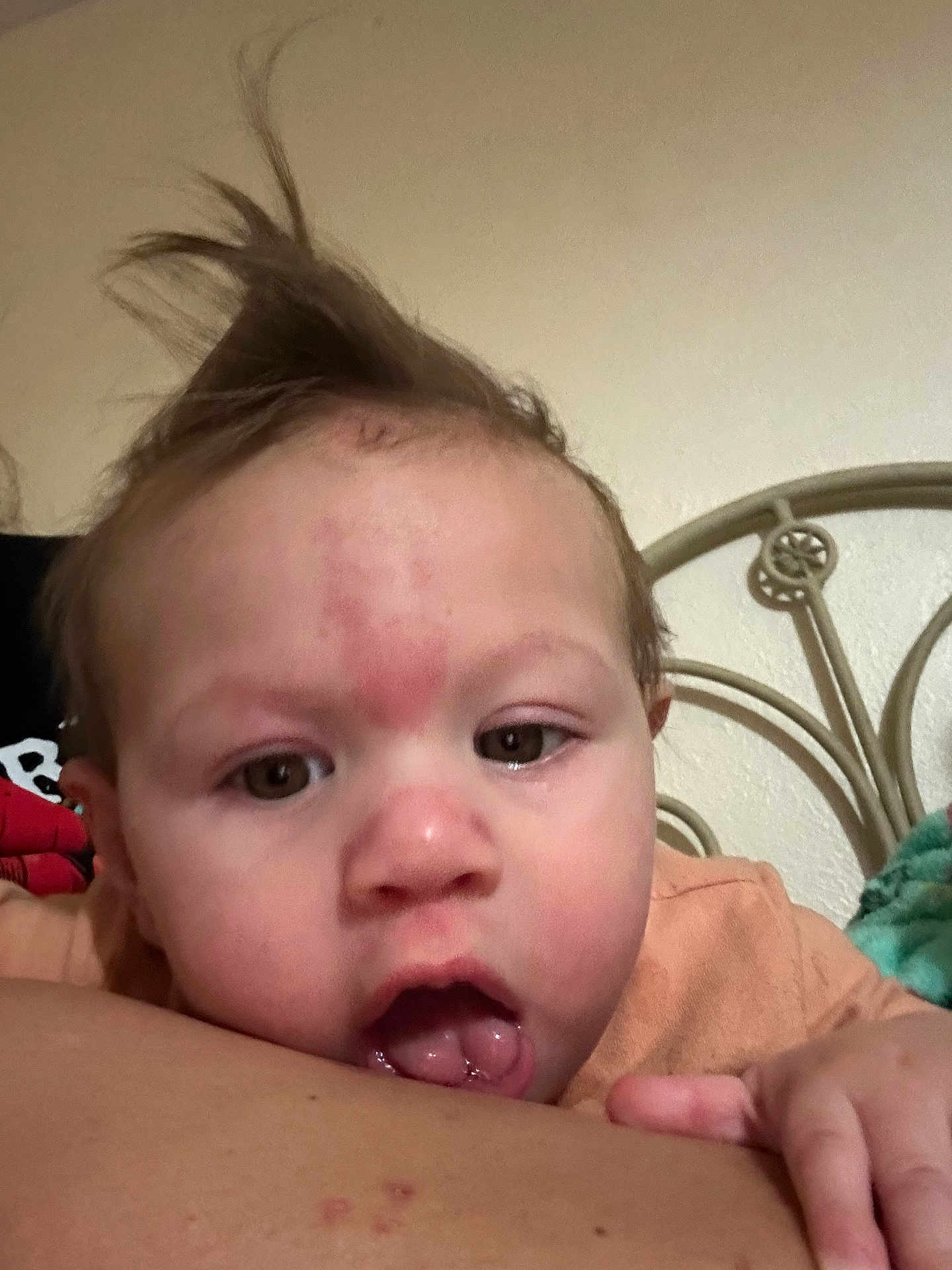 Matthias is registered to the contest to win money with this photo: baby, face, child, skin, hair, mouth, hand, arm, red_marks, bed_frame, indoor, close_up, curious, expression, person, young_child, skin_texture, resting, head, casual_clothing