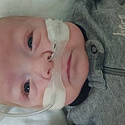 Zavian is registered to the contest to win money with this photo: baby, infant, nasal_tube, oxygen_tube, medical_device, lying_down, grey_clothing, animal_patch, close_up, face, head, skin, eyes, person, indoors, healthcare, newborn, cute, patient, hospital