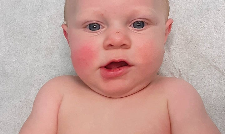 Robert is registered to the contest to win money with this photo: baby, baby_making_funny_faces, cheek, child, chin, close_up, eye, eyebrow, face, facial_expression, forehead, head, lip, mouth, neck, nose, organ, person, pink, skin