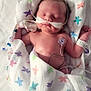newborn, baby, hospital, medical, blanket, butterfly_pattern, sleeping, tubes, monitoring, infant, healthcare, bed, patient, resting, cute, child, person, skin, head, hand
