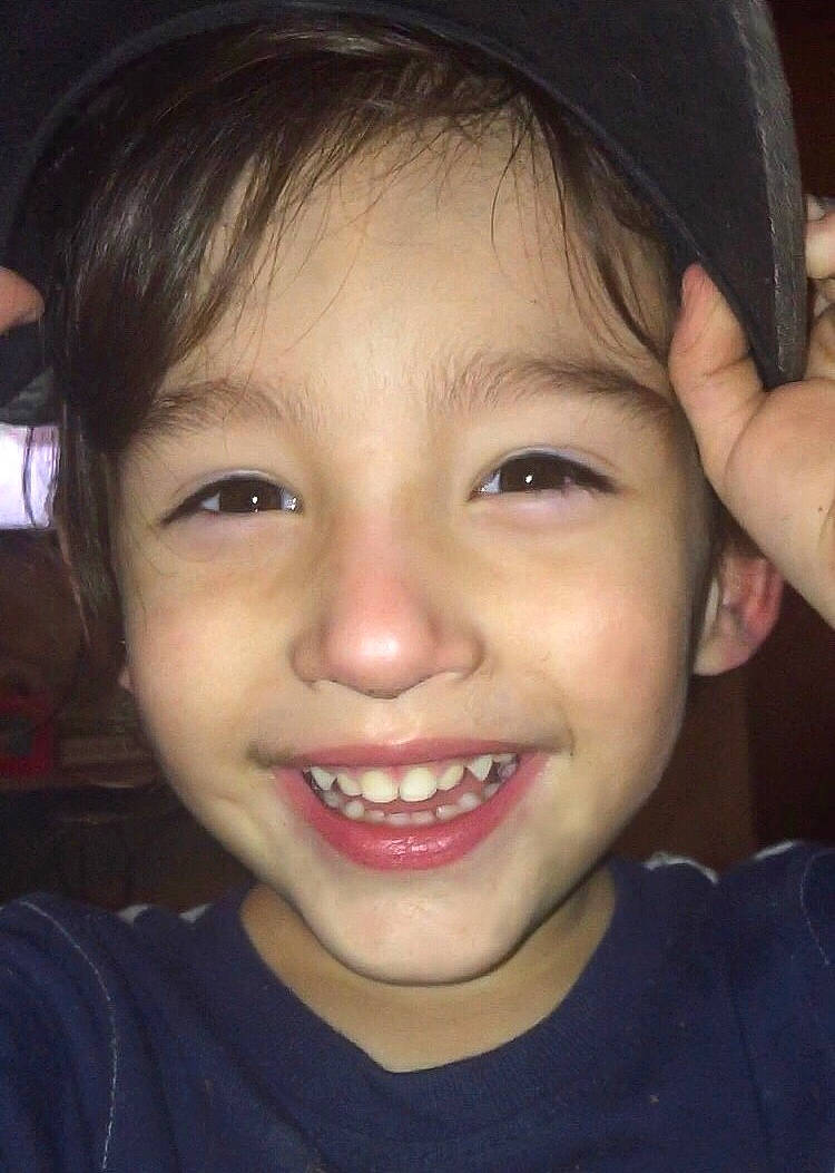 Anderson joined the competition — help win amazing prizes! cheek, child, chin, ear, eye, eyebrow, face, facial_expression, forehead, fun, hair, head, jaw, joy, lip, mouth, nose, organ, person, skin