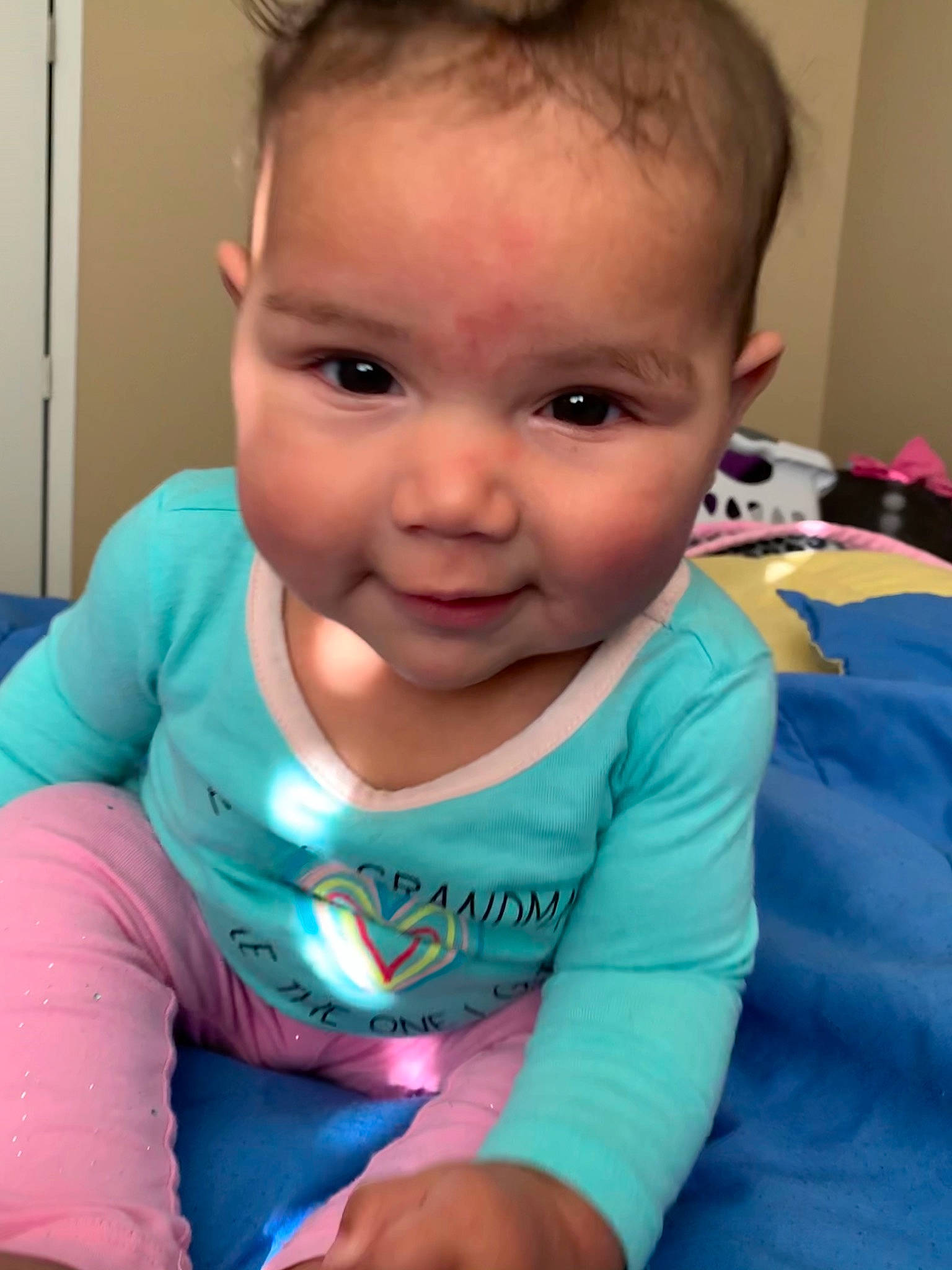 Samera is registered to the contest to win money with this photo: baby, cheek, child, chin, ear, eye, eyebrow, face, forehead, head, iris, lip, nose, person, skin, smile, toddler, tummy_time