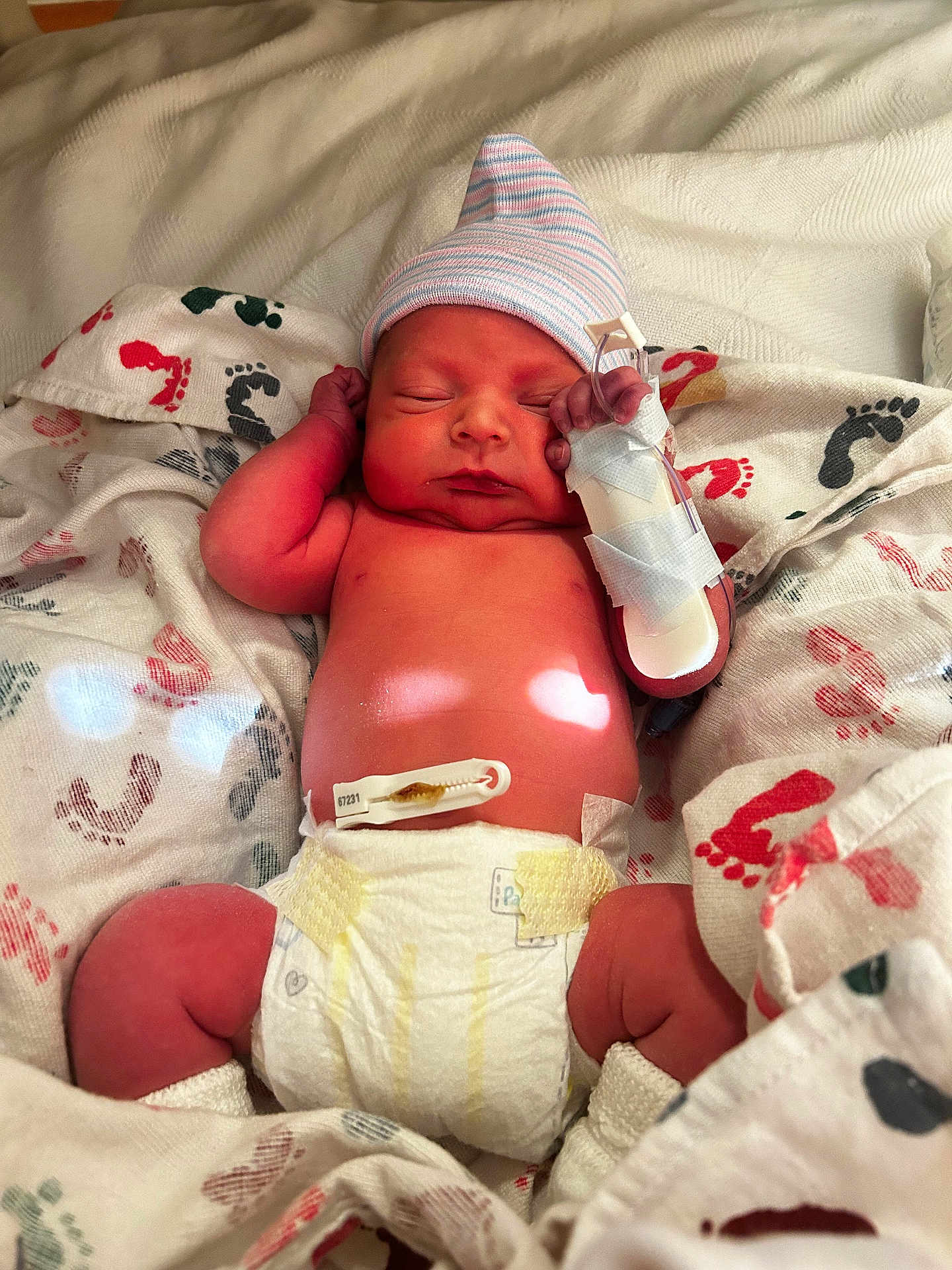 Houston is registered to the contest to win money with this photo: newborn, baby, diaper, blanket, hospital, hat, footprints, sleeping, medical_tape, monitor, infant, cute, child, resting, skin, human, bed, comfort, healthcare, swaddled