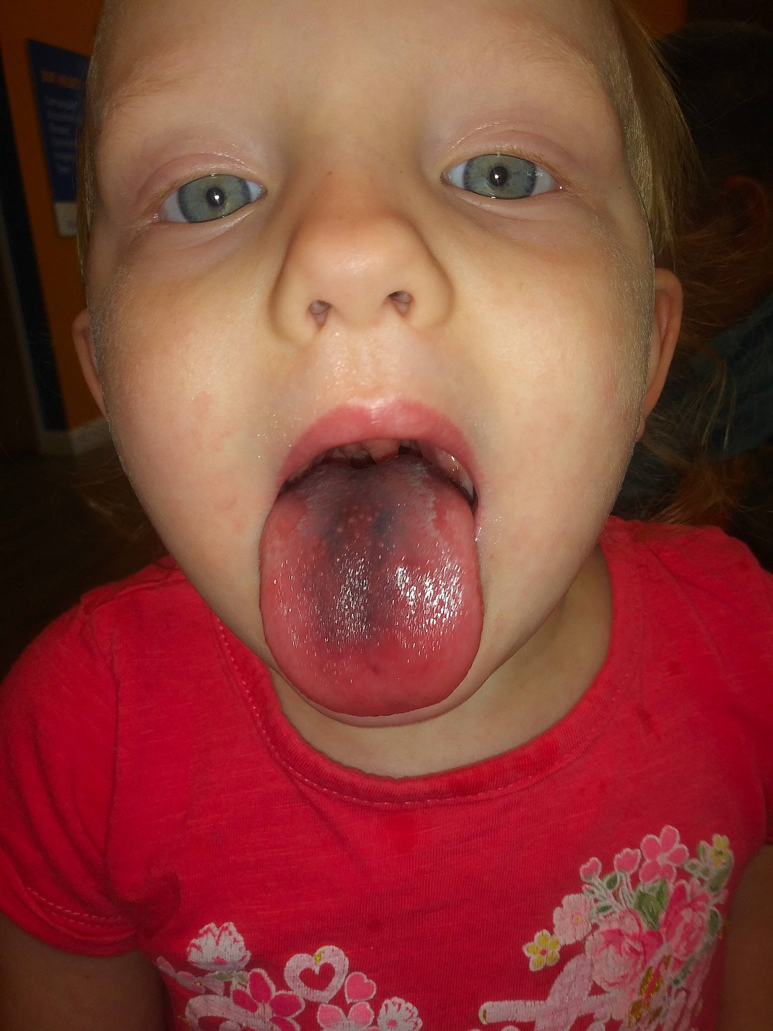 Hayven is registered to the contest to win money with this photo: baby, cheek, child, chin, close_up, face, facial_expression, human_body, jaw, lip, mouth, neck, nose, organ, person, skin, smile, surprise, toddler, tongue