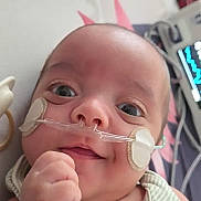 Matheo D joined the competition — help win amazing prizes! baby, infant, face, nasal_cannula, medical_patch, hospital, medical_equipment, striped_clothing, hand, lying_down, close_up, healthcare, child, person, cute, expression, indoors, monitor, smile, young