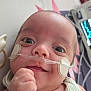 baby, infant, face, nasal_cannula, medical_patch, hospital, medical_equipment, striped_clothing, hand, lying_down, close_up, healthcare, child, person, cute, expression, indoors, monitor, smile, young