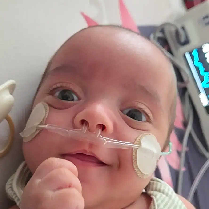 Matheo D joined the competition — help win amazing prizes! baby, child, close_up, cute, expression, face, hand, healthcare, hospital, indoors, infant, lying_down, medical_equipment, medical_patch, monitor, nasal_cannula, person, smile, striped_clothing, young