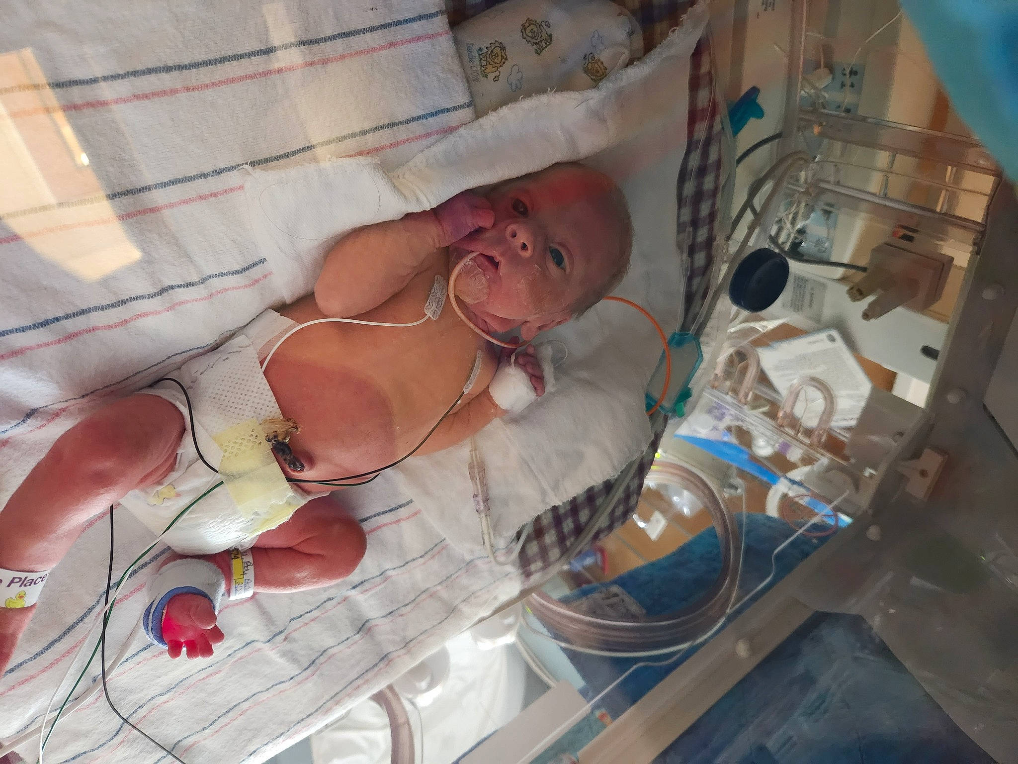 Greyson is registered to the contest to win money with this photo: abdomen, chest, comfort, event, eyewear, flesh, foot, hat, health_care, human_leg, linens, medical, medical_equipment, medical_procedure, patient, person, room, service, smile, thigh