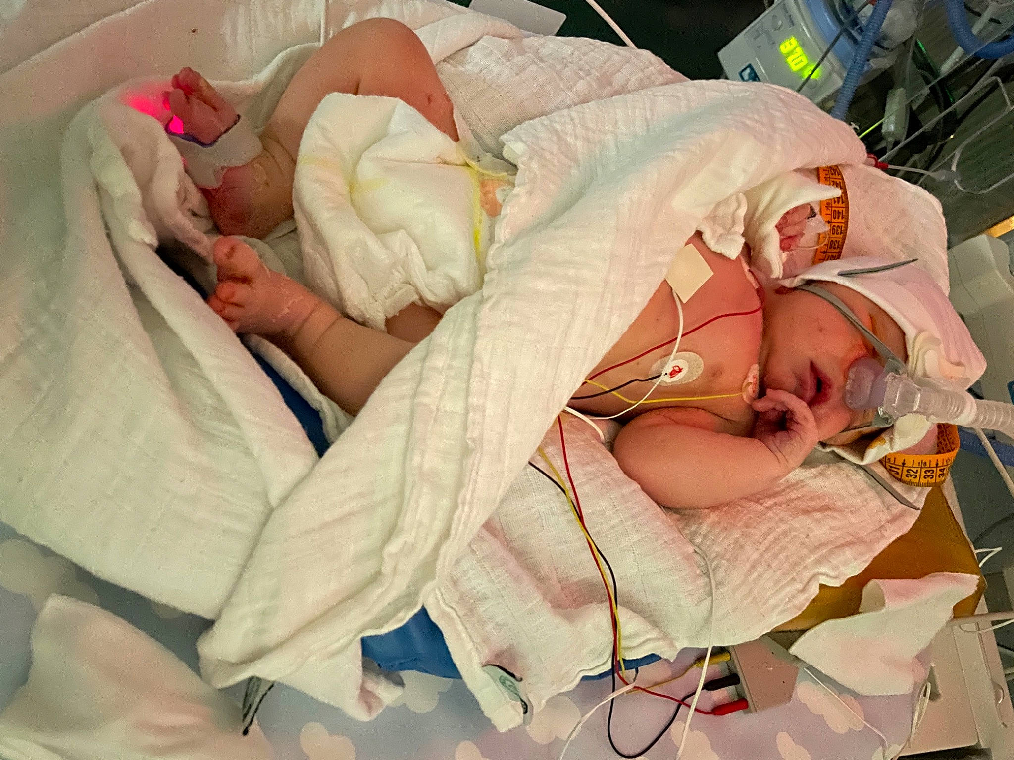 Zahyan participe au concours pour gagner de l'argent avec cette photo : abdomen, baby, baby_products, baby_sleeping, bedtime, child, childbirth, comfort, event, headwear, hospital, hospital_bed, linens, nap, patient, peach, person, room, service, skin