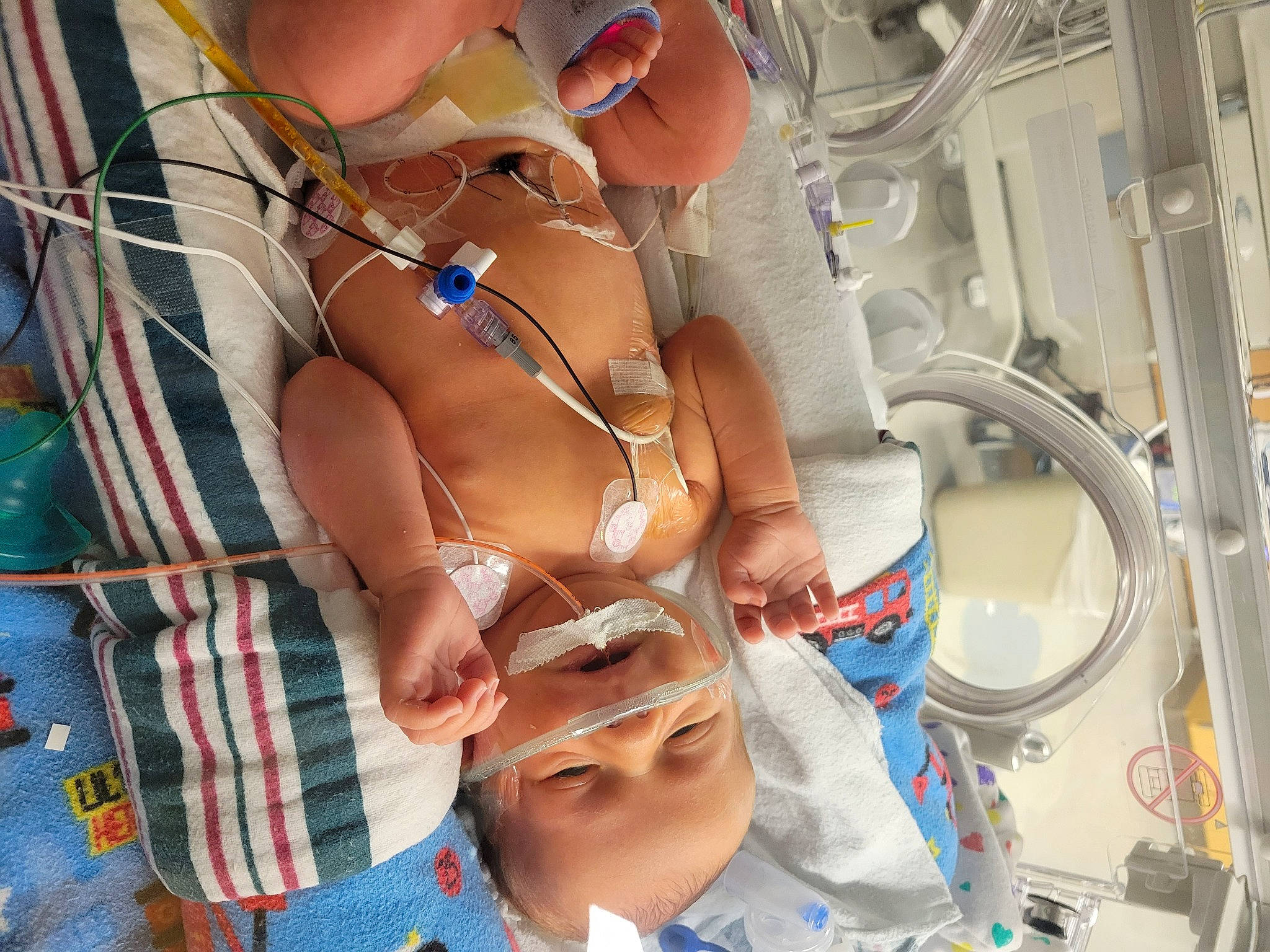 Jameson is registered to the contest to win money with this photo: abdomen, baby, chest, child, event, eyewear, glasses, hat, health_care, human_leg, leisure, medical_procedure, navel, pattern, person, service, sunglasses, swimwear, thigh, thumb