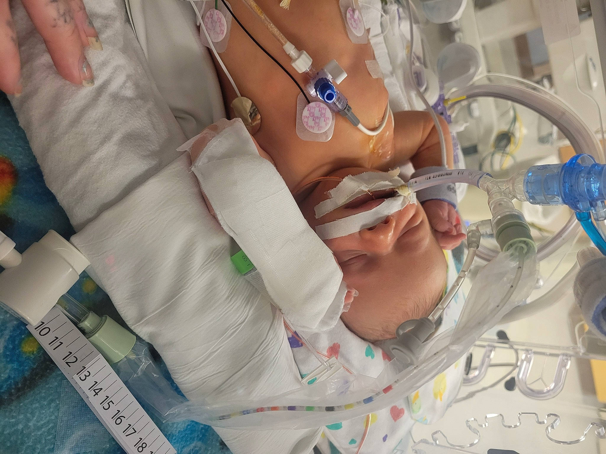 Jameson joined the competition — help win amazing prizes! baby, event, eyelash, eyewear, finger, hand, health_care, health_care_provider, hospital, hospital_bed, jewellery, medical, medical_equipment, medical_procedure, patient, person, science, service, skin, vision_care