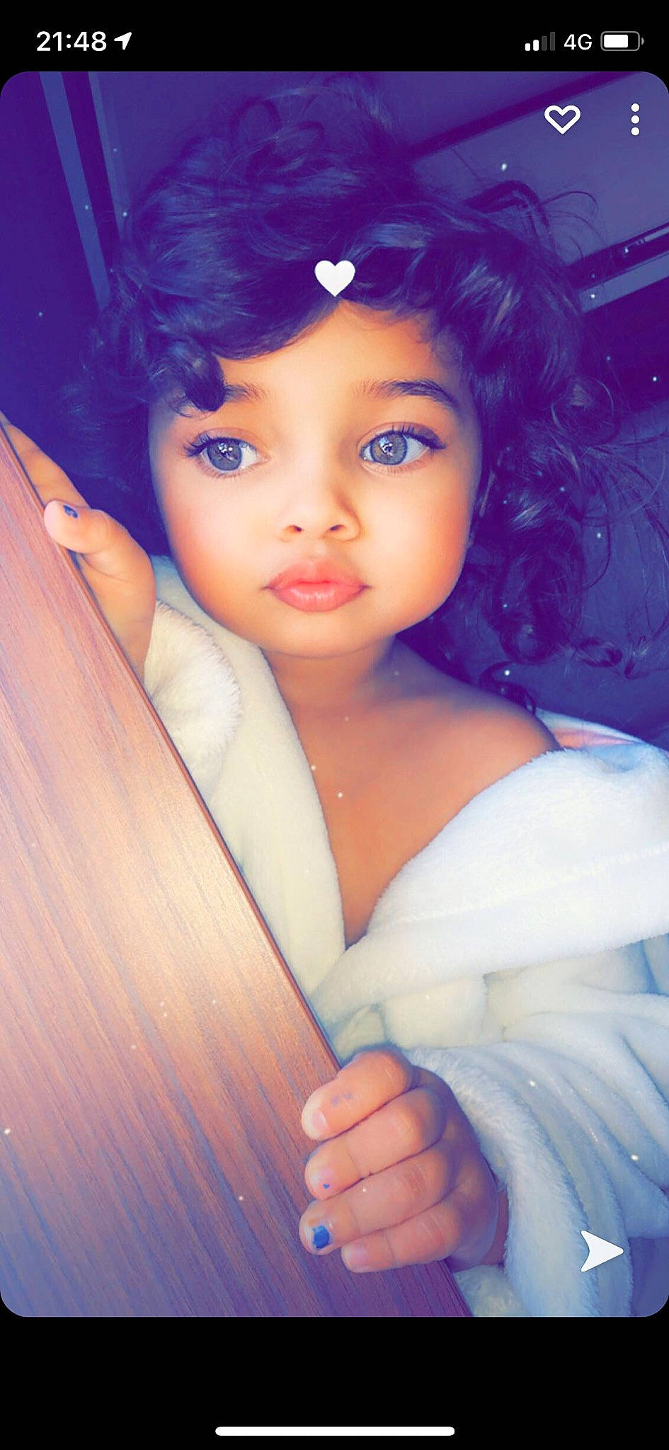 Iris participe au concours pour gagner de l'argent avec cette photo : arm, cheek, chin, eye, eyebrow, eyelash, facial_expression, flash_photography, hair, hairstyle, hand, head, human_body, iris, joint, lip, organ, person, shoulder, skin