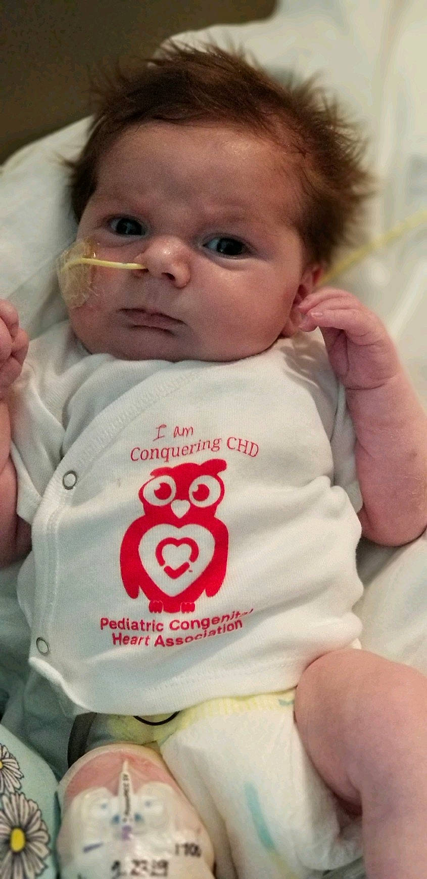 Kolten is registered to the contest to win money with this photo: baby, baby_products, baby_toddler_clothing, cheek, child, lip, nose, person, skin, toddler