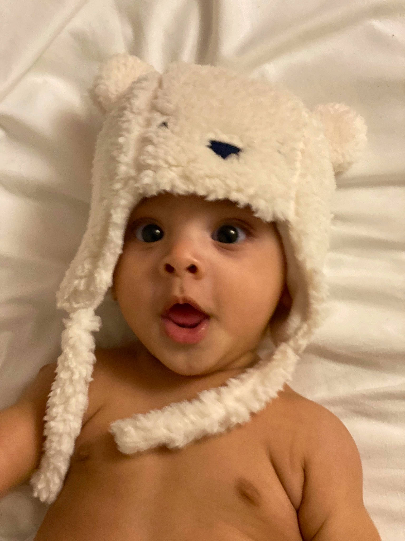 Liam participe au concours pour gagner de l'argent avec cette photo : cap, cheek, eye, eyebrow, eyelash, facial_expression, flash_photography, hand, happy, head, headgear, headwear, iris, lip, mammal, nose, outerwear, person, skin, surprise