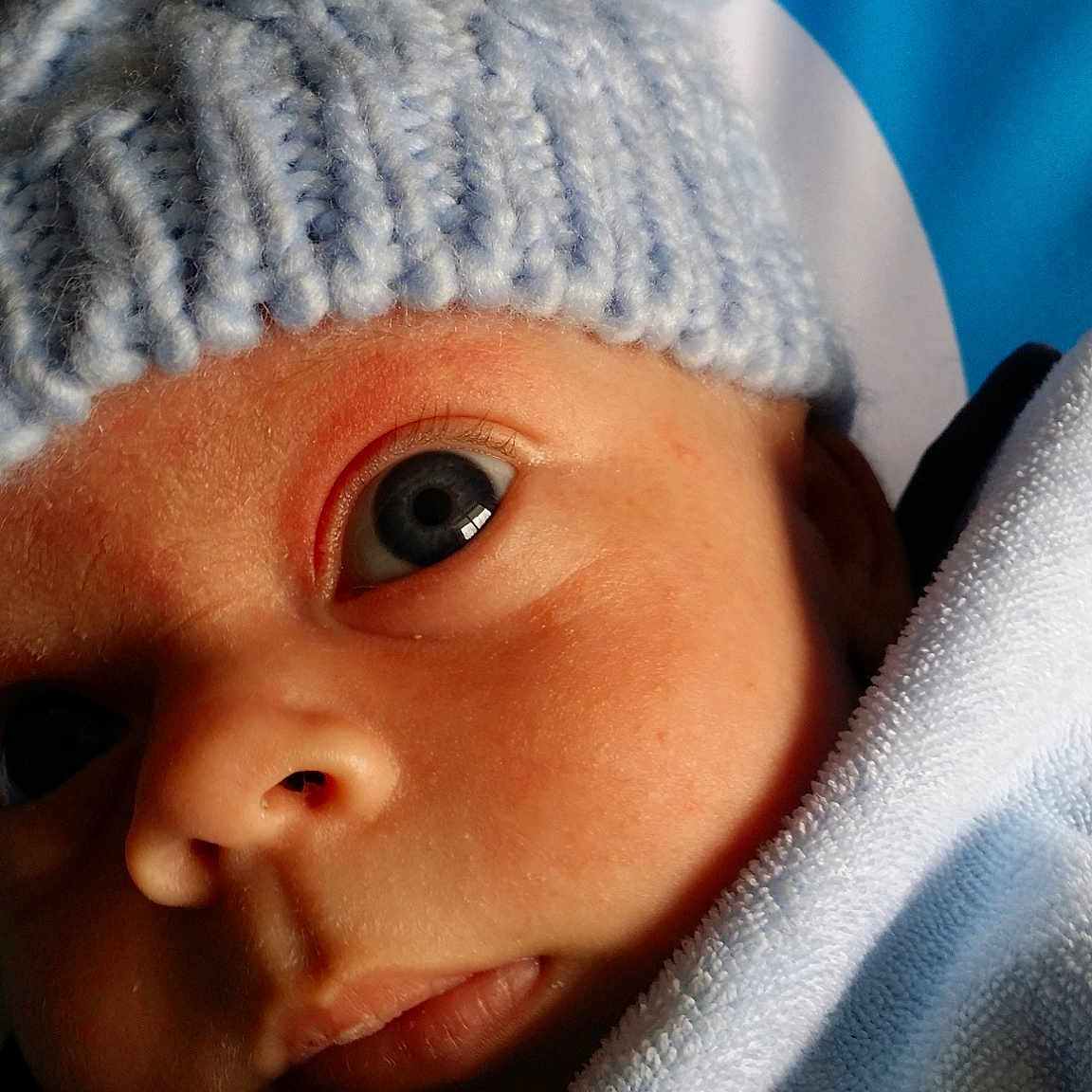 Nathon is registered to the contest to win money with this photo: baby, beanie, bonnet, cheek, child, close_up, eye, face, head, headgear, knit_cap, lip, mouth, nose, person, skin, toddler