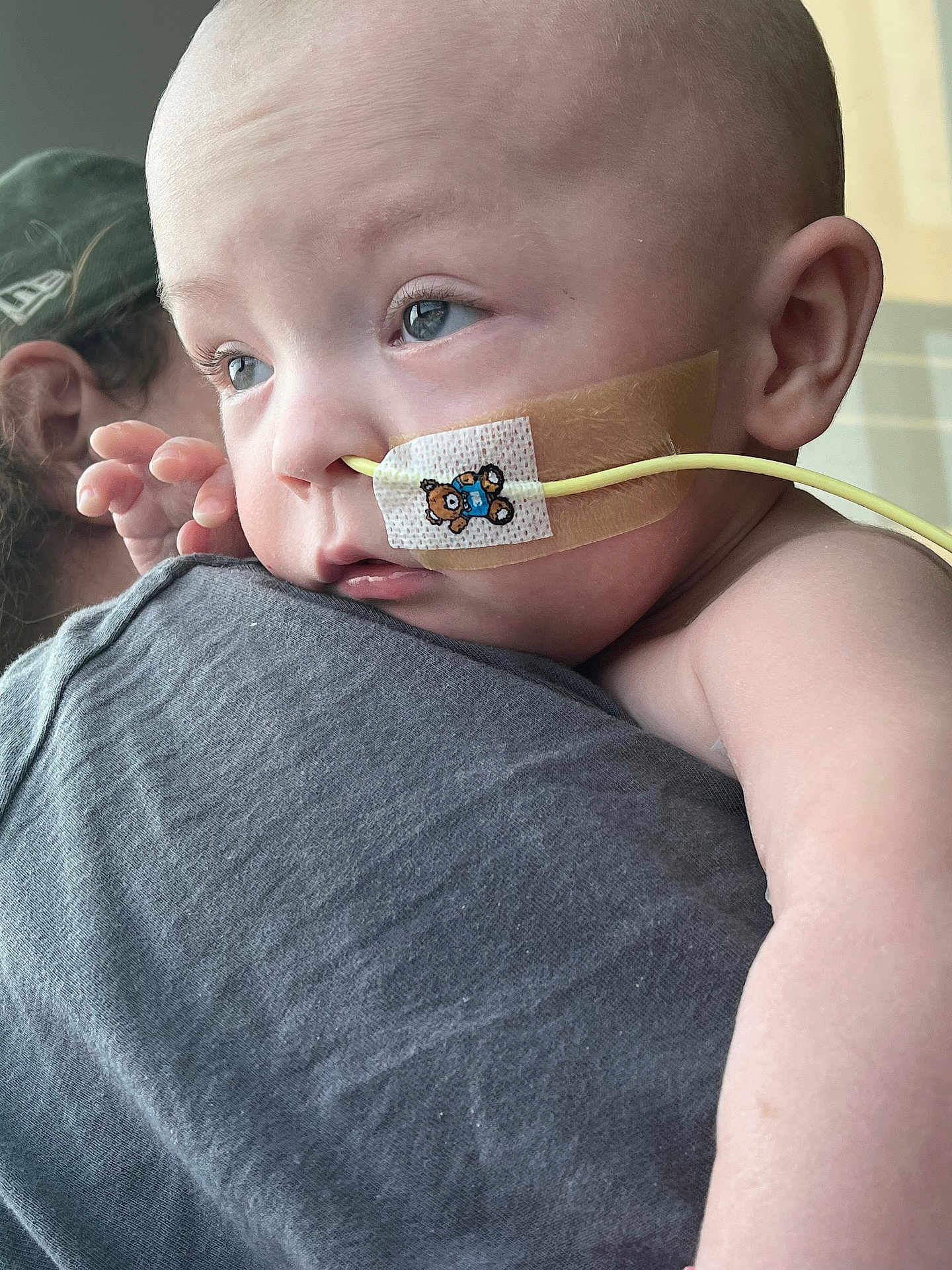 Brayden is registered to the contest to win money with this photo: baby, infant, face, medical_tube, tape, teddy_bear_sticker, adult, shoulder, skin, close_up, hospital, care, child, person, healthcare, expression, comfort, support, indoor, head