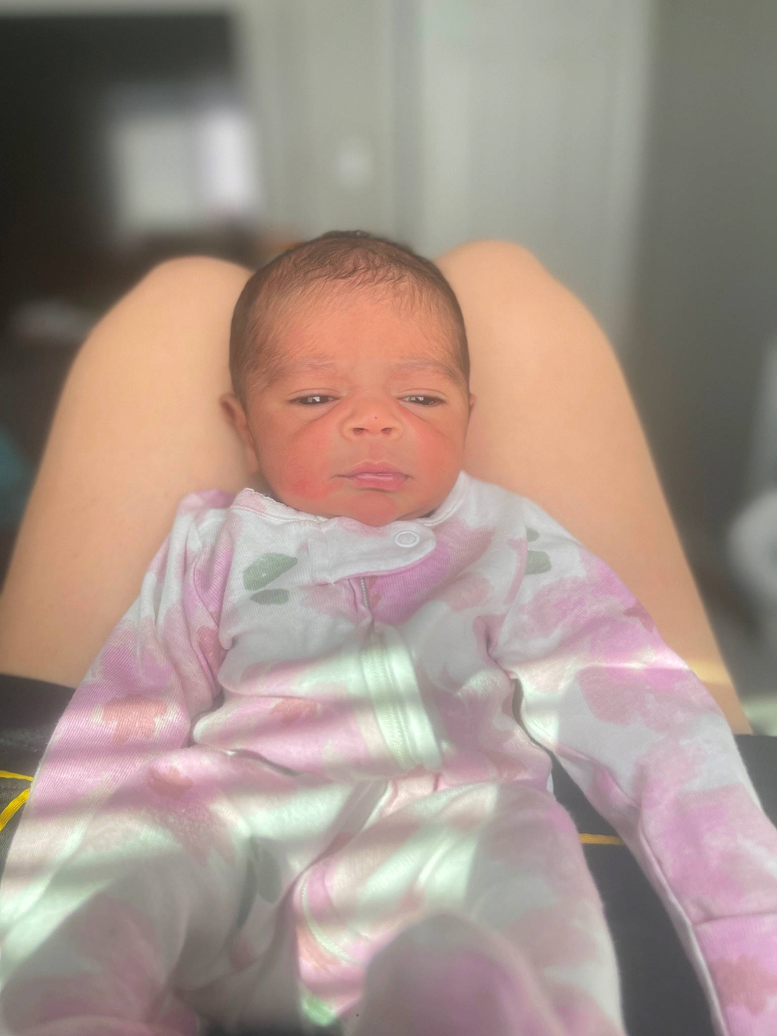 Emersyn is registered to the contest to win money with this photo: abdomen, arm, baby, baby_toddler_clothing, cheek, chest, comfort, eye, eyebrow, eyelash, face, finger, human_body, iris, linens, lip, mouth, nose, person, skin