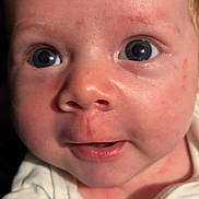 Joel is registered to the contest to win money with this photo: baby, infant, face, closeup, eyes, skin, red_spots, clothing, white_outfit, expression, curious, portrait, child, human, newborn, cute, young, baby_garment, head, indoors