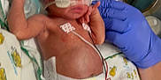 Mia is registered to the contest to win money with this photo: newborn, baby, medical_equipment, gloves, tattoo, arm, diaper, monitoring_wires, hospital, blanket, cartoon_print, infant, person, skin, hand, medical_tape, bed, healthcare, cute, small