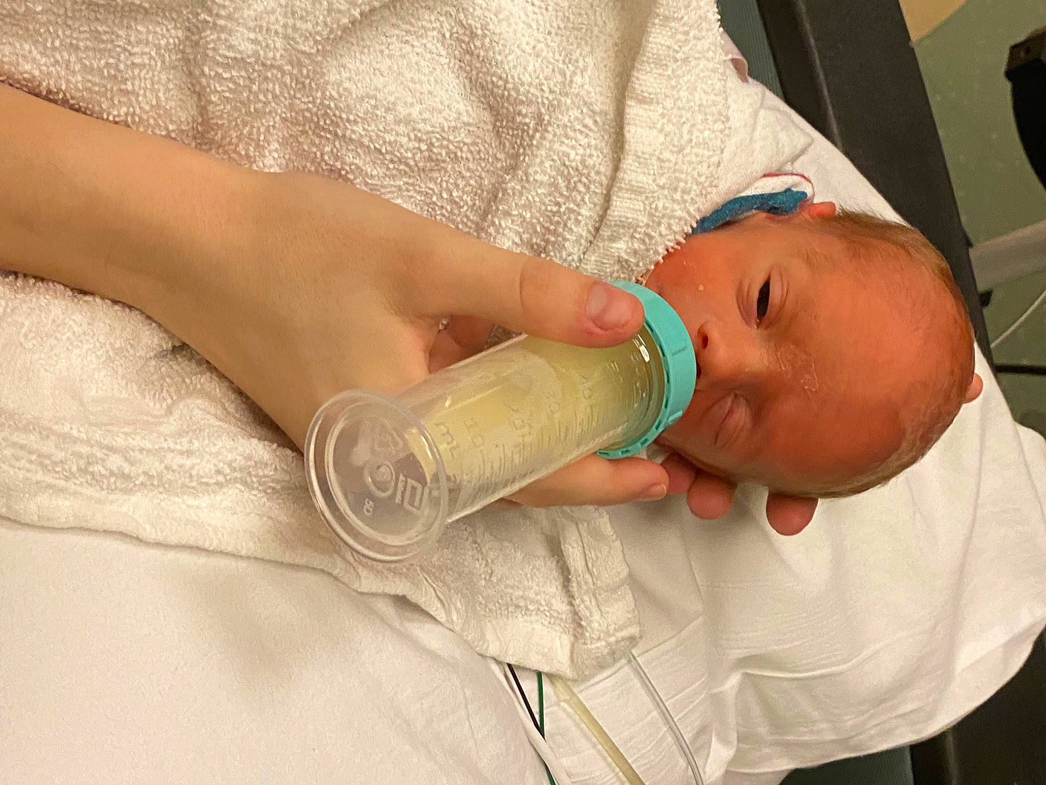 Niklaus is registered to the contest to win money with this photo: arm, baby, child, hand, patient, person, skin