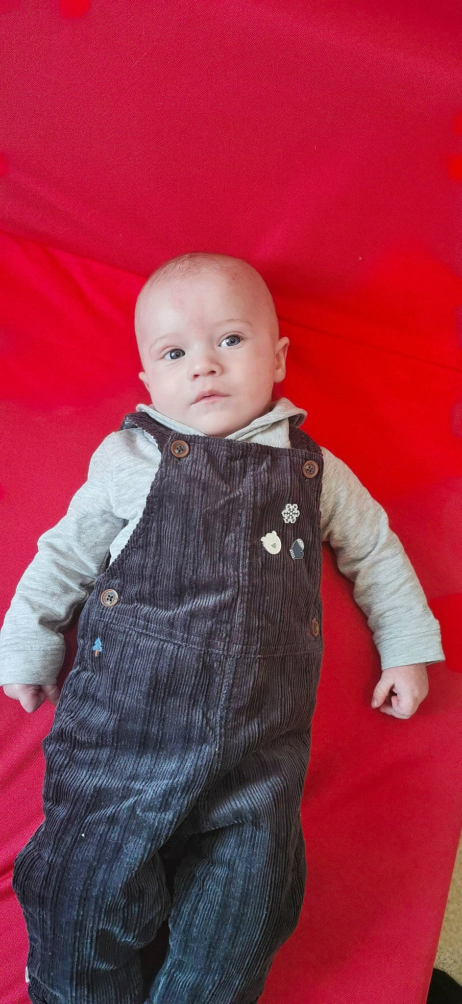 Eliott participe au concours pour gagner de l'argent avec cette photo : baby, baby_toddler_clothing, button, cheek, child, child_model, collar, ear, embellishment, human_body, linens, pattern, person, skin, sleeve, textile, toddler