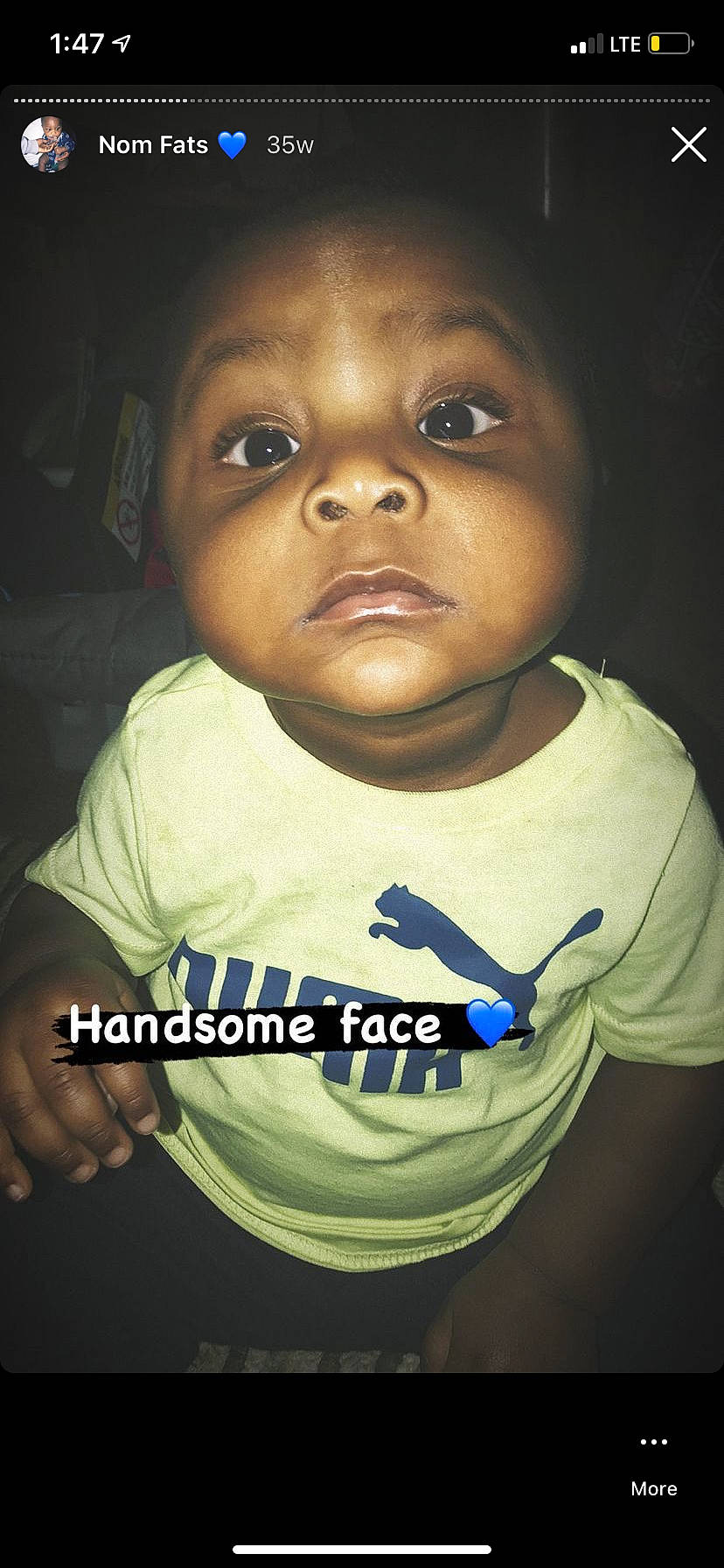 Devon is registered to the contest to win money with this photo: cheek, chin, eye, eyebrow, eyelash, facial_expression, flash_photography, forehead, gesture, happy, head, human, jaw, lip, mammal, mouth, nose, organ, person, skin