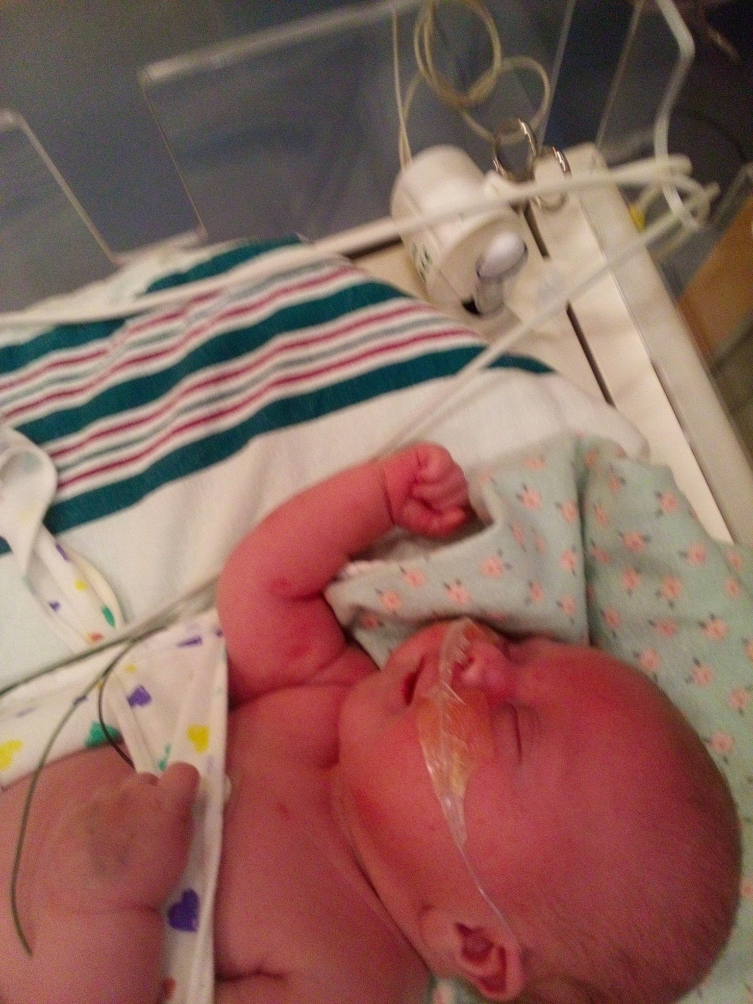 Briella joined the competition — help win amazing prizes! abdomen, baby, bed, chest, comfort, finger, hand, hospital, human_body, linens, medical, medical_equipment, medical_procedure, mouth, patient, person, service, skin, textile, thumb