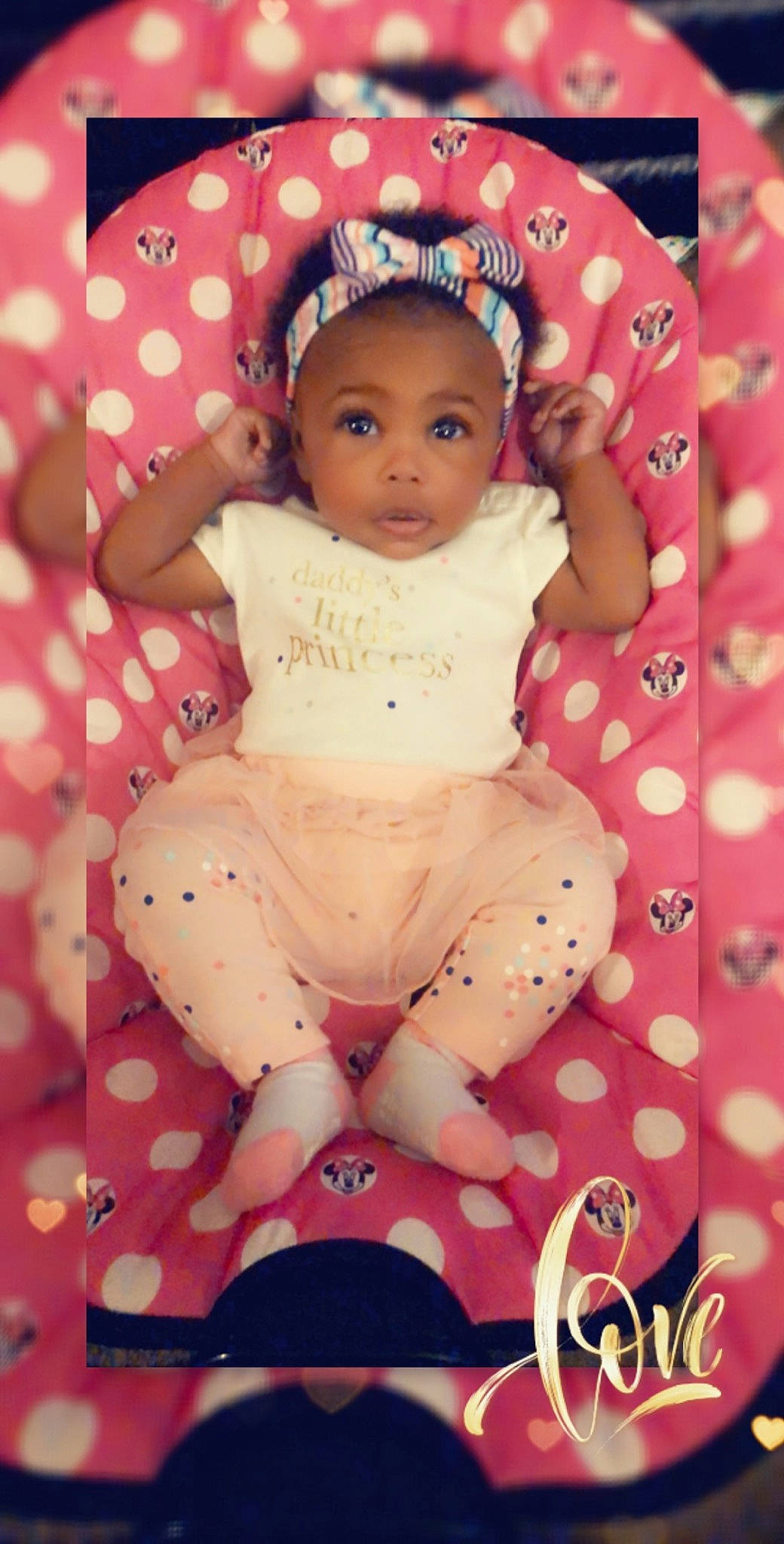 Asè is registered to the contest to win money with this photo: baby, baby_toddler_clothing, cheek, child, design, pattern, person, pink, skin, toddler