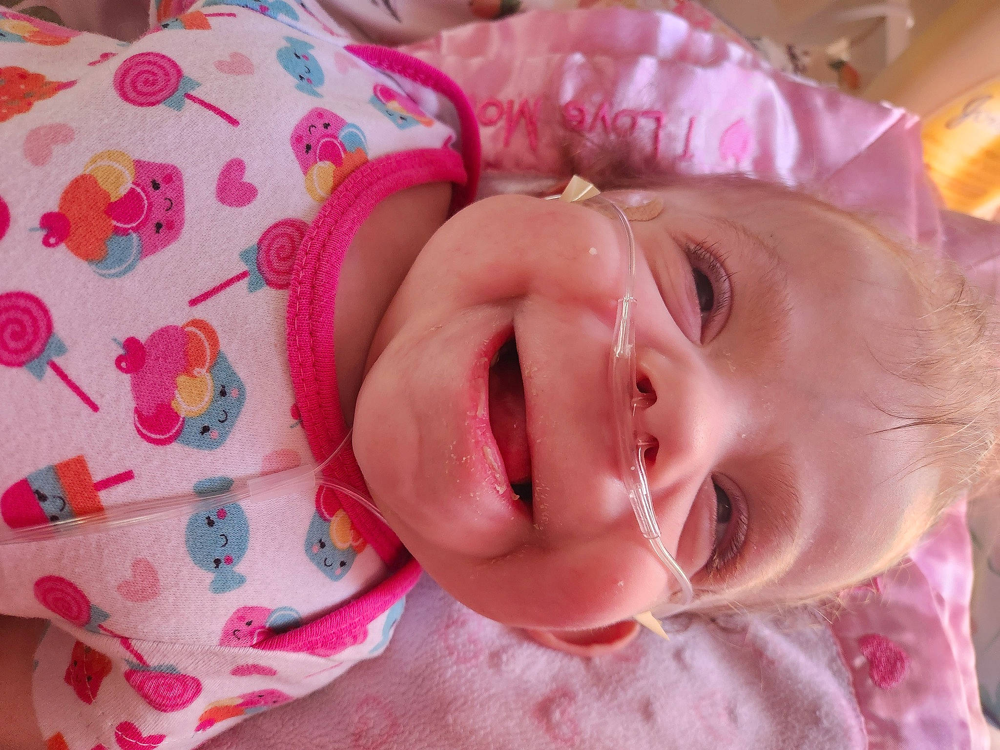 Nora joined the competition — help win amazing prizes! baby, baby_toddler_clothing, cheek, child, chin, eyebrow, eyelash, face, finger, happy, headgear, iris, joy, lip, magenta, mouth, nose, person, pink, skin