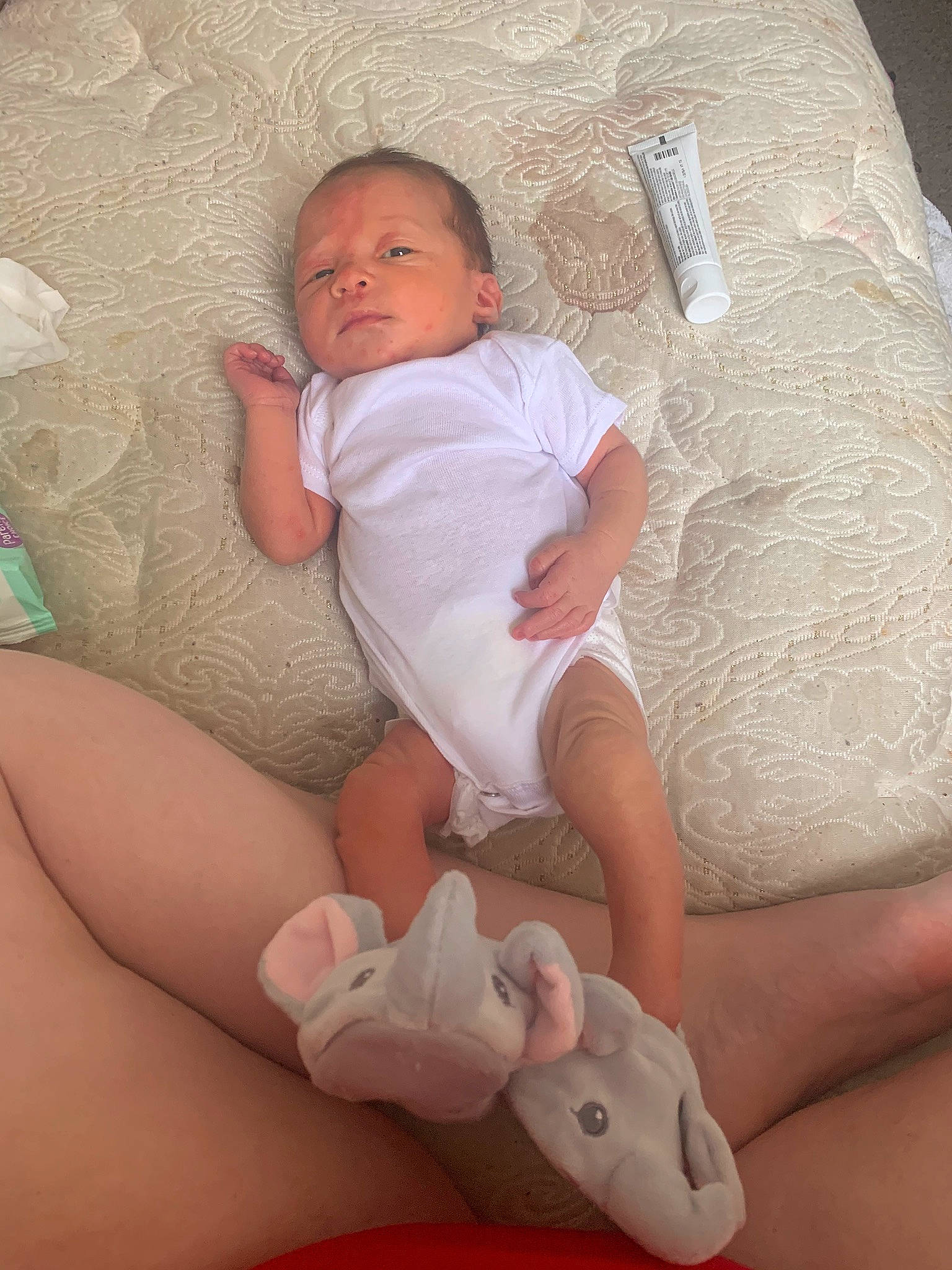 Austyn joined the competition — help win amazing prizes! baby, child, diaper, finger, knee, leg, person, skin, thigh, toddler