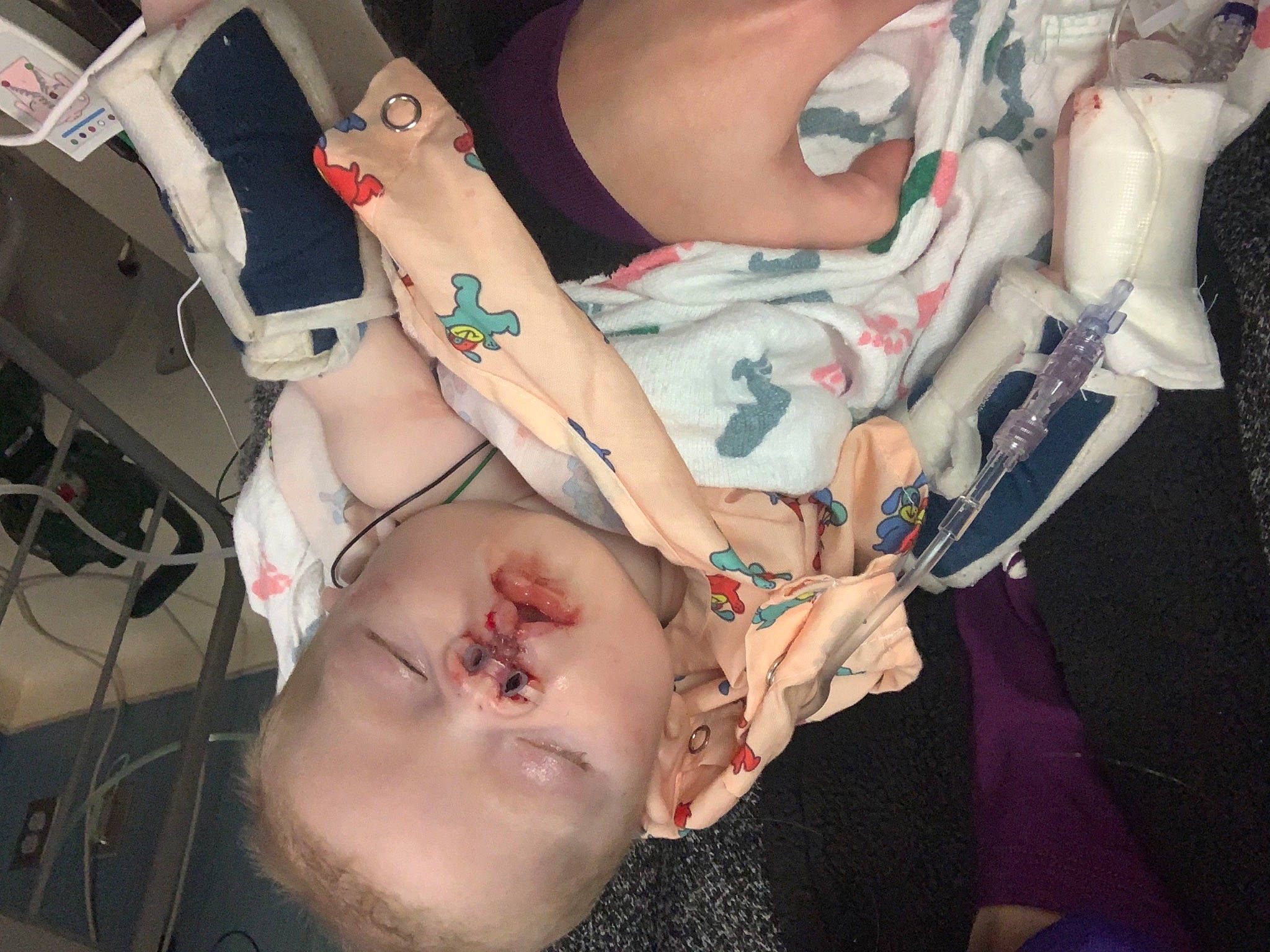 Keelyn joined the competition — help win amazing prizes! abdomen, bracelet, chest, flesh, human, joint, medical_procedure, nail, patient, person, skin, stomach, tattoo, temporary_tattoo, throat, trunk, wrist