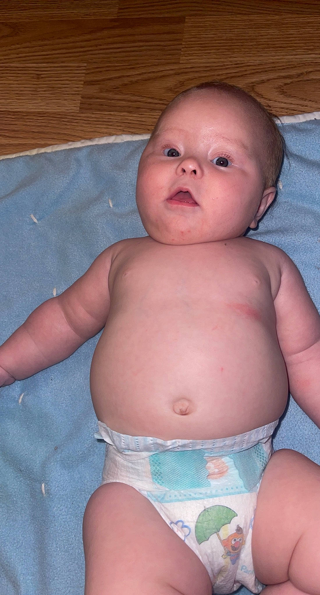 Kinsleigh is registered to the contest to win money with this photo: abdomen, baby, cheek, chest, chin, eye, eyebrow, eyelash, finger, human_body, iris, mouth, neck, nose, person, skin, stomach, thigh, thumb, toddler