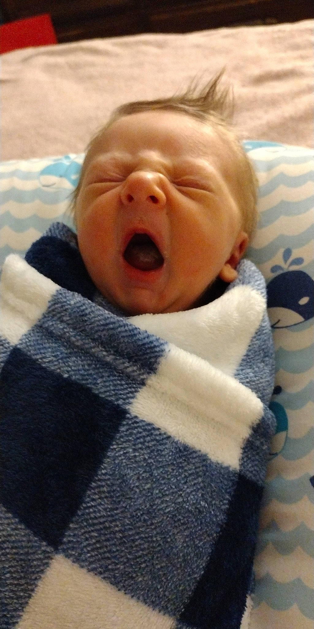 Austyn