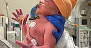 Sylis is registered to the contest to win money with this photo: baby, bedside, care, cute, diaper, fragile, gloves, healthcare, hospital, infant, medical, medical_equipment, monitoring, neonatal, newborn, orange_hat, patient, person, small, tubes