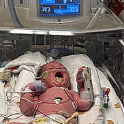 Sylis joined the competition — help win amazing prizes! baby, bed, blanket, child, crying, cute, diaper, healthcare, hospital, incubator, infant, medical_care, medical_equipment, monitor, newborn, patient, person, sensor, tube, wristband