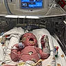 baby, bed, blanket, child, crying, cute, diaper, healthcare, hospital, incubator, infant, medical_care, medical_equipment, monitor, newborn, patient, person, sensor, tube, wristband