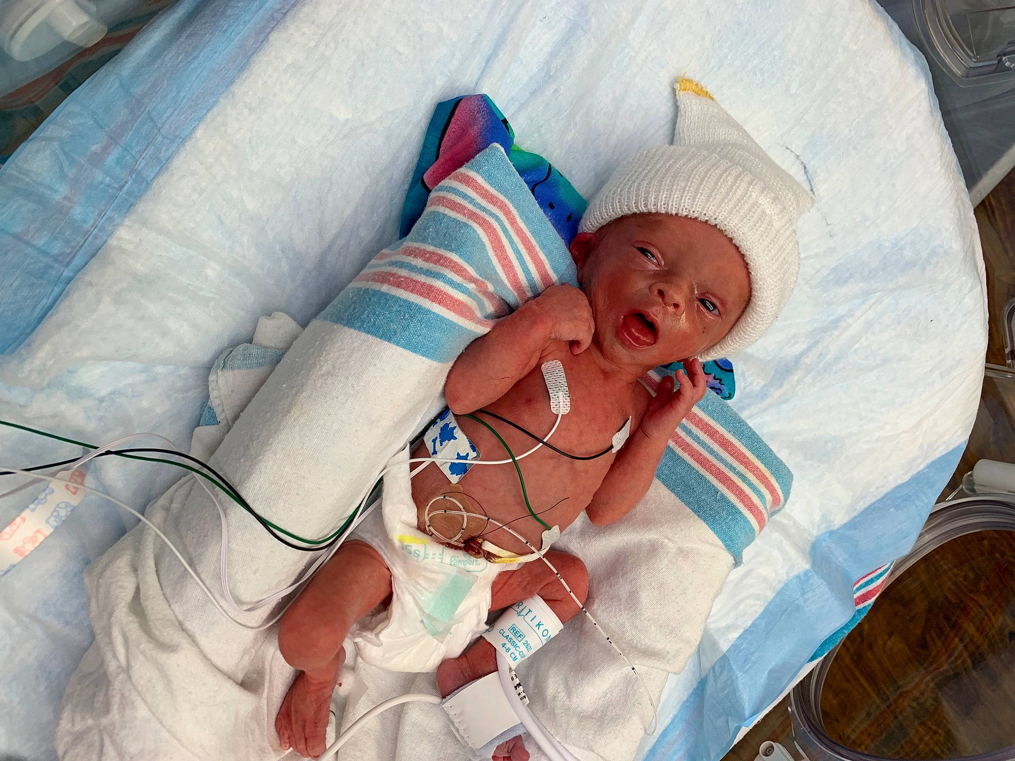 Brayden is registered to the contest to win money with this photo: baby, baby_products, baby_sleeping, bedding, child, comfort, event, hat, headwear, health_care, hospital, linens, medical, medical_equipment, medical_procedure, patient, person, room, skin, smile