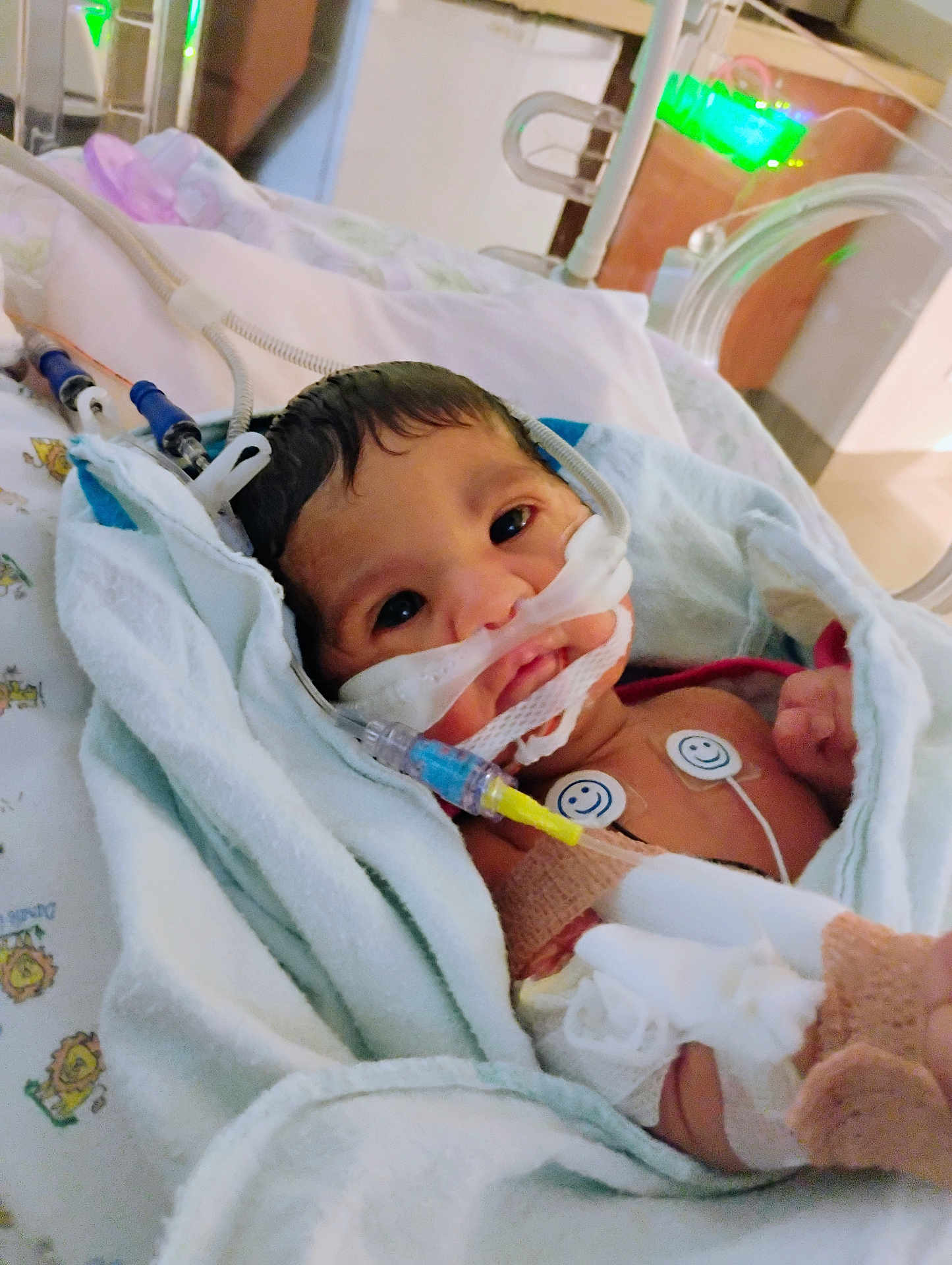 Journe'E is registered to the contest to win money with this photo: newborn, baby, hospital, medical_tubes, monitoring_sensors, wrapped_in_blanket, face, eyes, infant, healthcare, patient, bed, cute, small, towel, smileys, closeup, lying_down, indoors, person