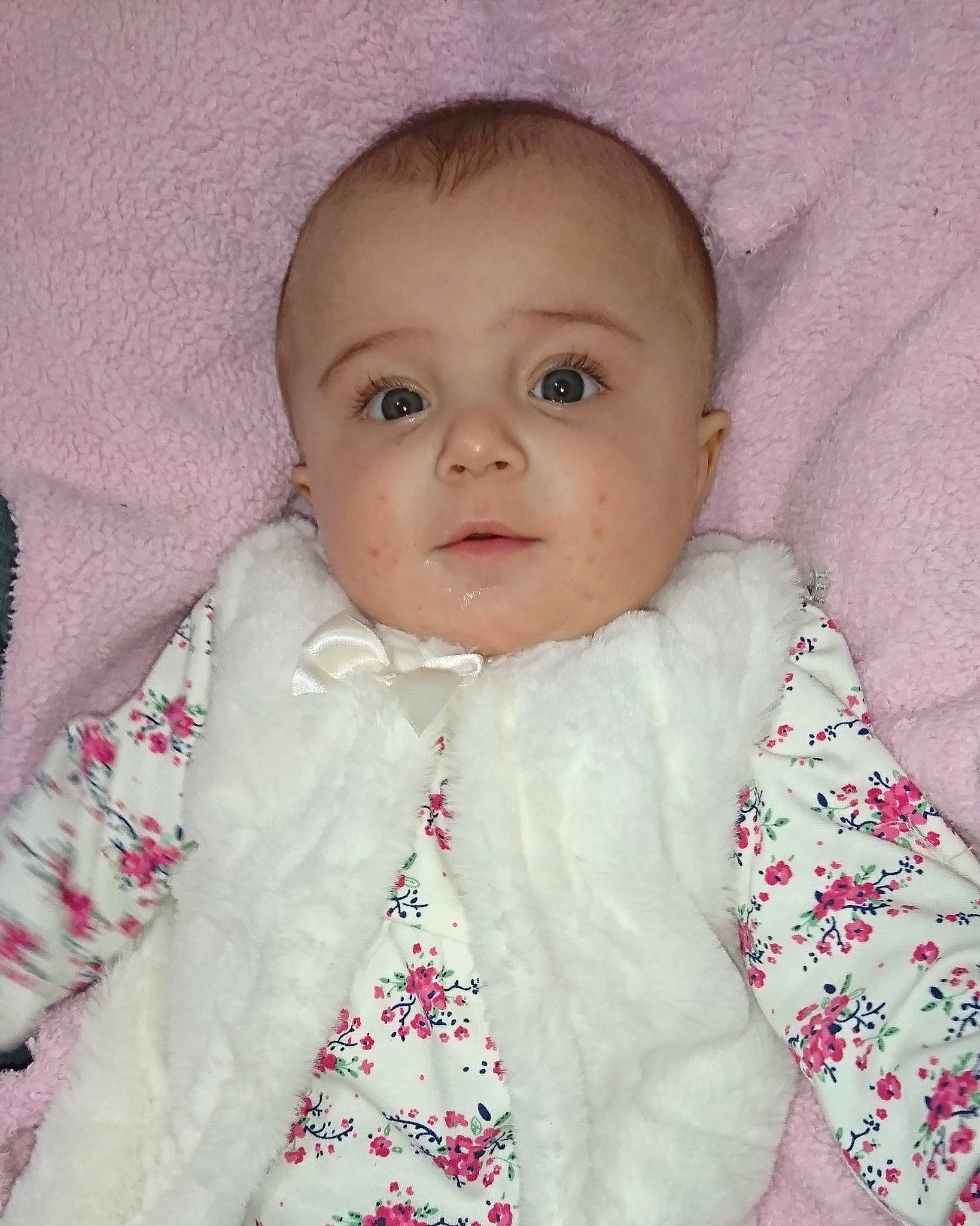 Lyhana participe au concours pour gagner de l'argent avec cette photo : baby, cheek, child, chin, eye, face, forehead, head, iris, lip, mouth, nose, outerwear, person, pink, skin, smile, textile, toddler