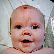 Charley joined the competition — help win amazing prizes! baby, infant, face, blue_eyes, smile, skin, head, towel, mark, scratch, closeup, child, person, happy, expression, cute, young, portrait, indoors, skin_detail