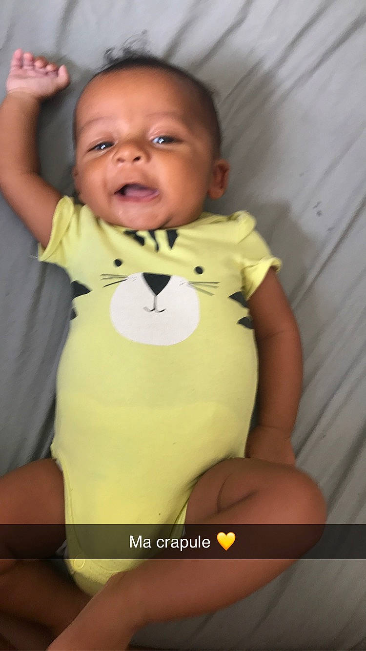 Gianni participe au concours pour gagner de l'argent avec cette photo : arm, baby, baby_products, baby_toddler_clothing, cheek, child, person, skin, smile, toddler, yellow