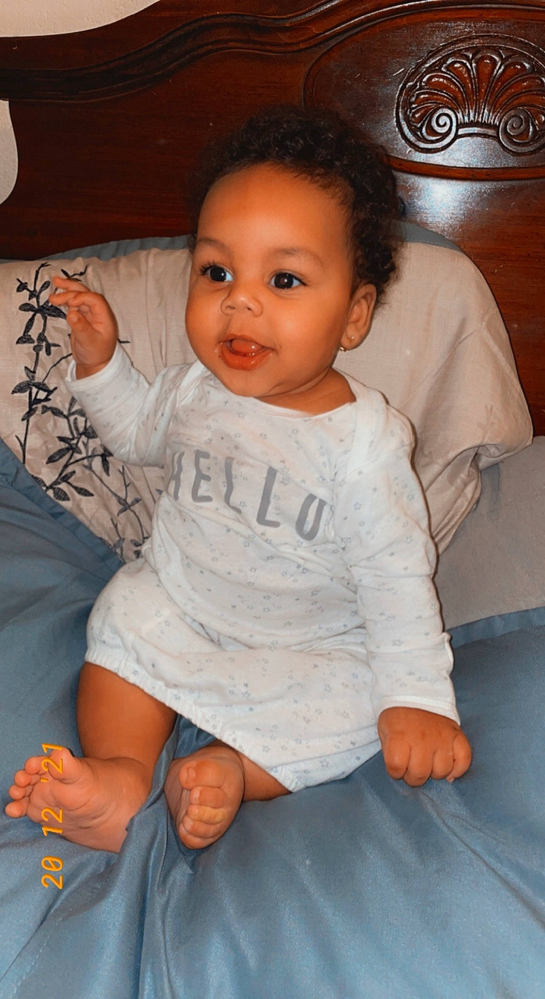 Jakobi is registered to the contest to win money with this photo: arm, baby_toddler_clothing, cheek, chin, comfort, dress, eye, finger, hair, hand, head, iris, leg, lip, mouth, neck, nose, person, skin, sleeve