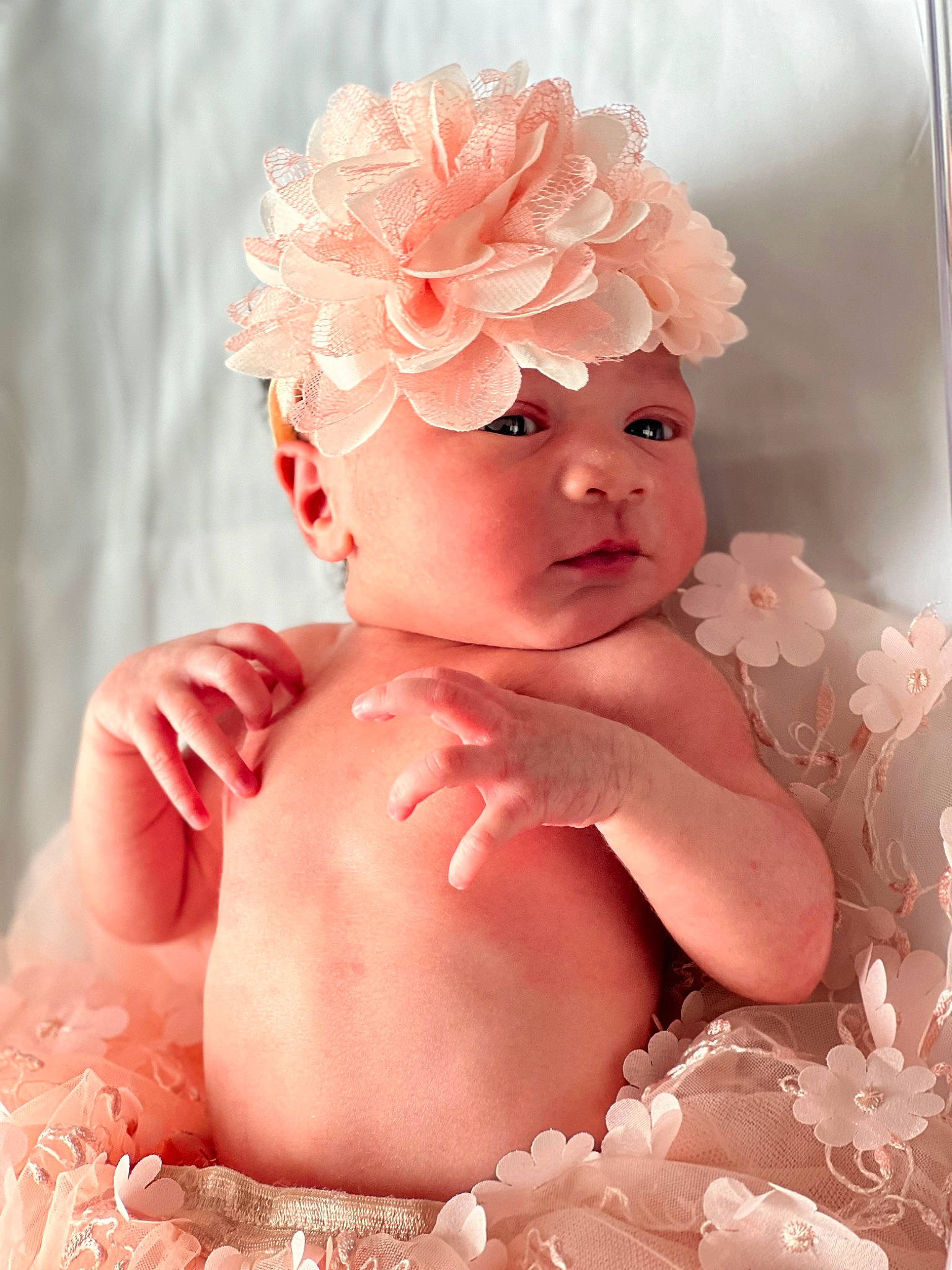 Treasure joined the competition — help win amazing prizes! arm, baby, baby_toddler_clothing, cap, cheek, eye, eyebrow, eyelash, face, finger, hand, head, headgear, headwear, leg, lip, person, petal, pink, skin